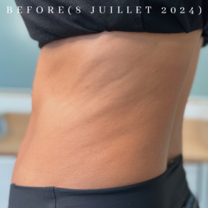 Auriol Jouvence Centre esthétique médicale jet peel radiofréquence lumière pulsée épilation drainage lymphatique led peau soin