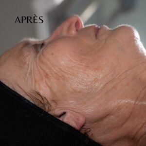 Auriol Jouvence Centre esthétique médicale jet peel radiofréquence lumière pulsée épilation drainage lymphatique led peau soin